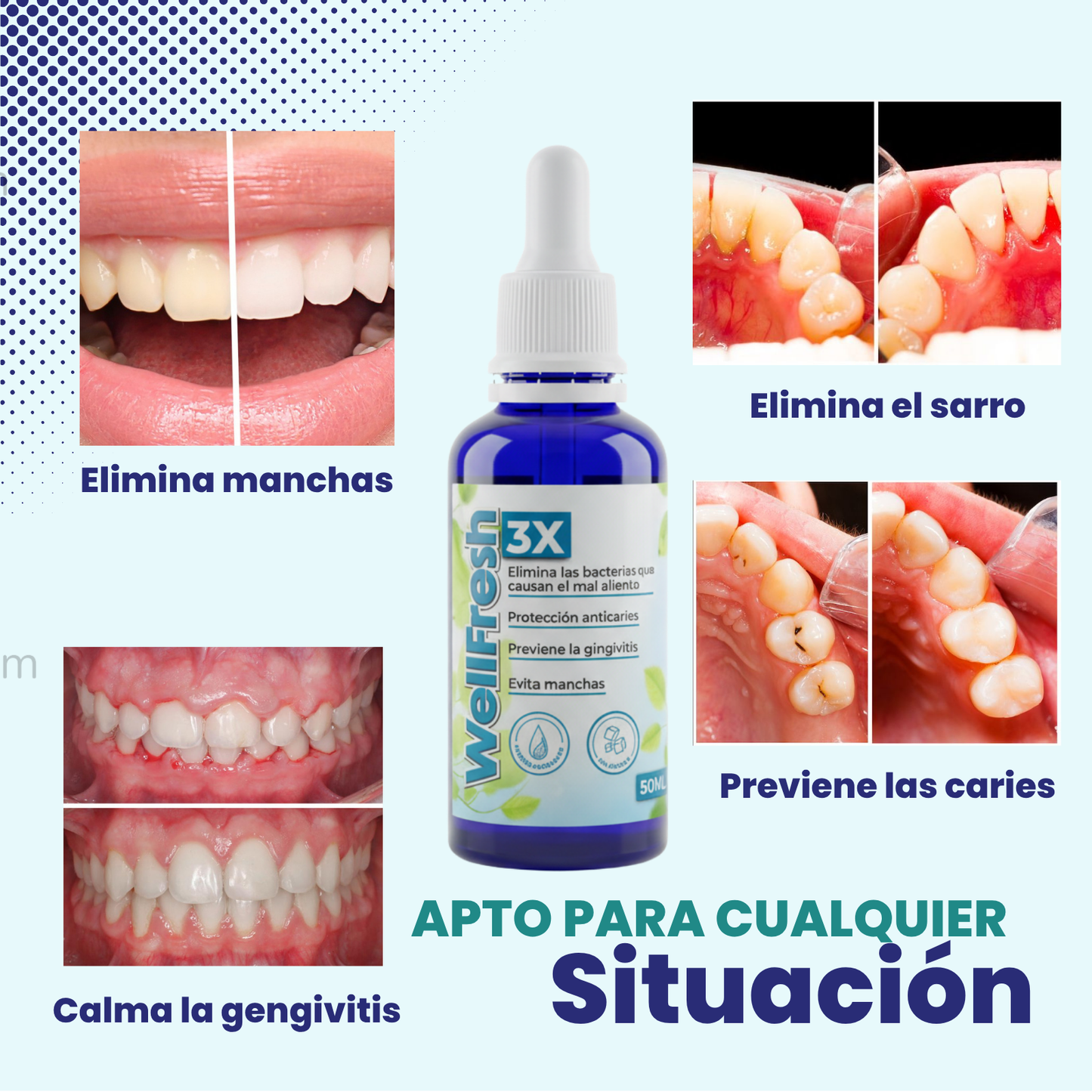 Tratamiento Dental para eliminar Manchas y Sarro
