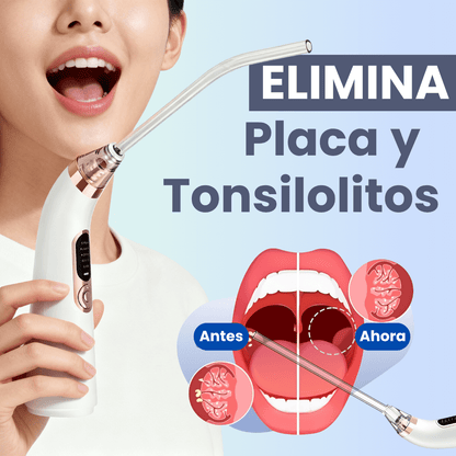 Kit eliminador de tonsilolitos | Elimina el mal aliento