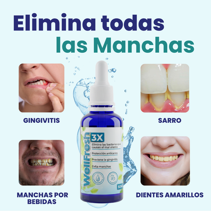 Tratamiento Dental para eliminar Manchas y Sarro