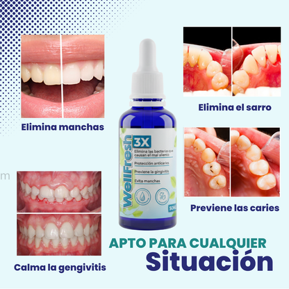 Tratamiento Dental para eliminar Manchas y Sarro