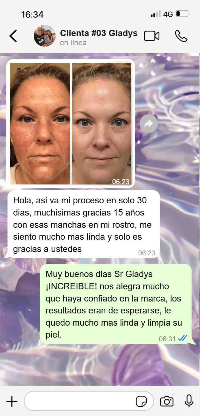 Carrusel_1_Niavix-min_5.jpg__PID:0a1c1af7-26b2-41f7-8902-ec56ddeab018