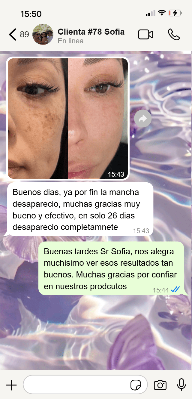 Carrusel #2 Niavix-min.png__PID:bb198151-9343-4568-99c3-ce756efdb185