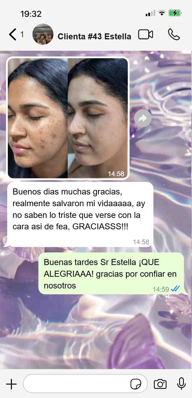 Carrusel_3_Niavix-min_3.jpg__PID:26b2a1f7-4902-4c56-9dea-b018e12ebdcf