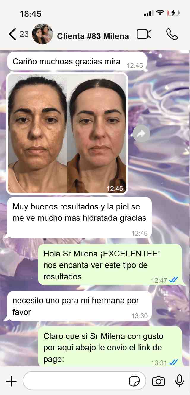 Carrusel_4_Niavix-min_2.jpg__PID:a1f74902-ec56-4dea-b018-e12ebdcf65ff