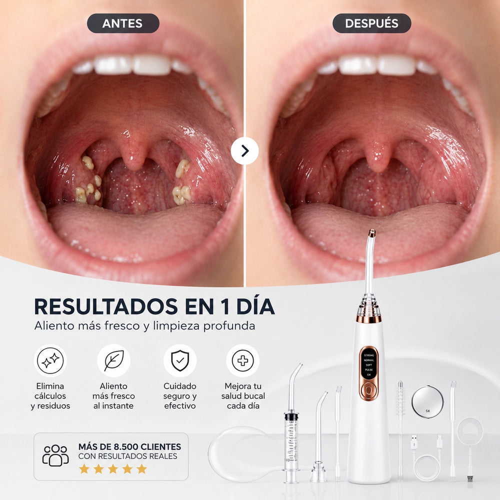 Kit eliminador de tonsilolitos | Elimina el mal aliento